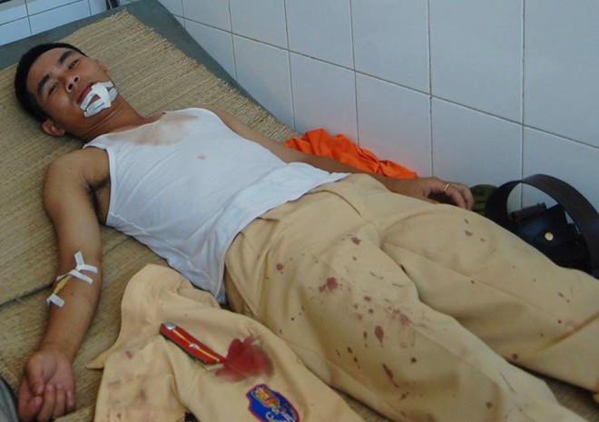 Thiếu úy Hiếu dũng cảm bắt giữ kẻ giang hồ đâm chém người đi đường.