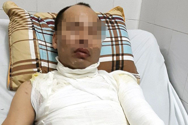 Anh H. điều trị tại bệnh viện.