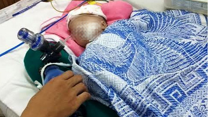 Bệnh nhi đang được điều trị tại Bệnh viện Nhi đồng 2, TP HCM. Ảnh: LC.