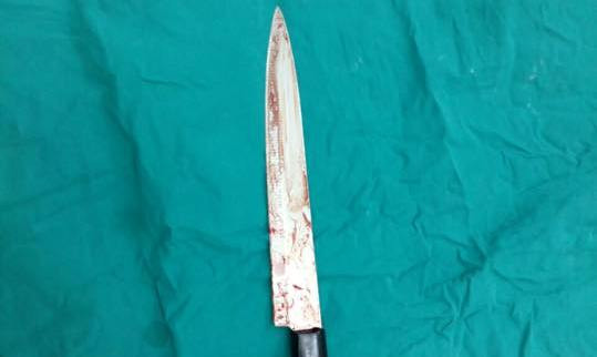 Lưỡi dao được lấy ra từ đùi nạn nhân