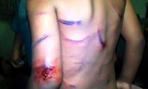 Hình ảnh 'bé 7 tuổi bị cha dượng hành hung' được cho là ở bên... Thái Lan.