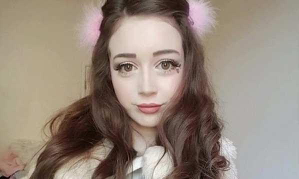 Hannah với khuôn mặt đẹp như búp bê. Ảnh: Mirror.