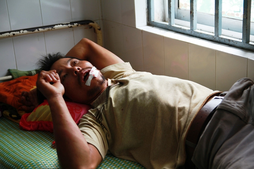 Anh Đặng Văn Thông đang được cấp cứu tại khoa Răng Hàm Mặt, bệnh viện đa khoa tỉnh Quảng Nam