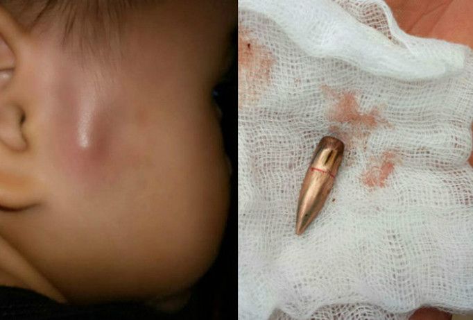 Bản tin 8H: Đạn lạc găm trúng nhiều người ở Vĩnh Phúc