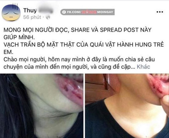 Hình ảnh chia sẻ trên mạng xã hội.