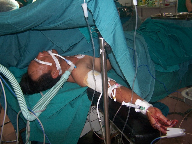 Các bác sĩ đang nối cánh tay cho anh Sửu