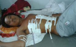 Ném dép vào bạn, dính hàng chục phát dao