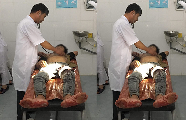 Em C. nhập viện cấp cứu do bạn học đâm. Ảnh: Báo Giao thông