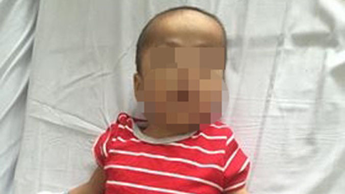 Cháu D. đang nằm điều trị tại Bệnh viện Nhi Trung ương.