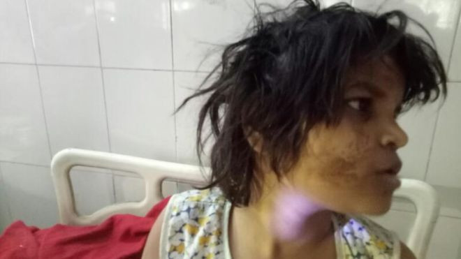 Cô bé Forest Durga được tìm thấy sống trong rừng với bầy khỉ hoang dã