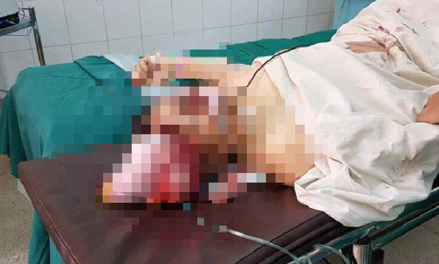 Phát hiện sự việc, gia đình đã đưa chị Thúy đi cấp cứu trong tình trạng nguy kịch