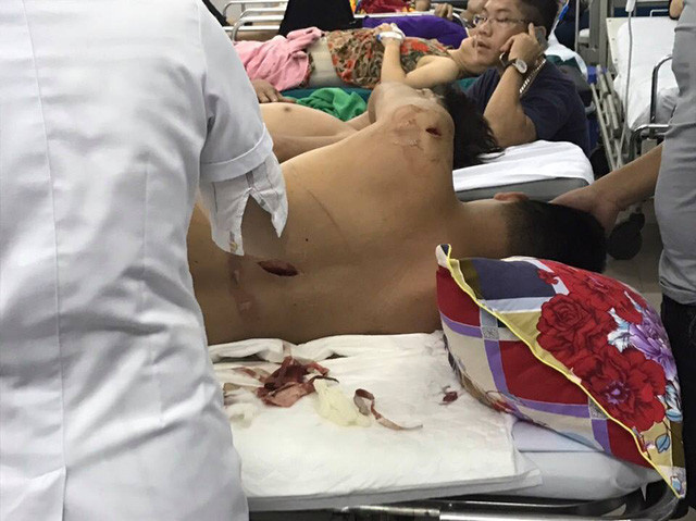 Nạn nhận bị chém hơn chục nhát