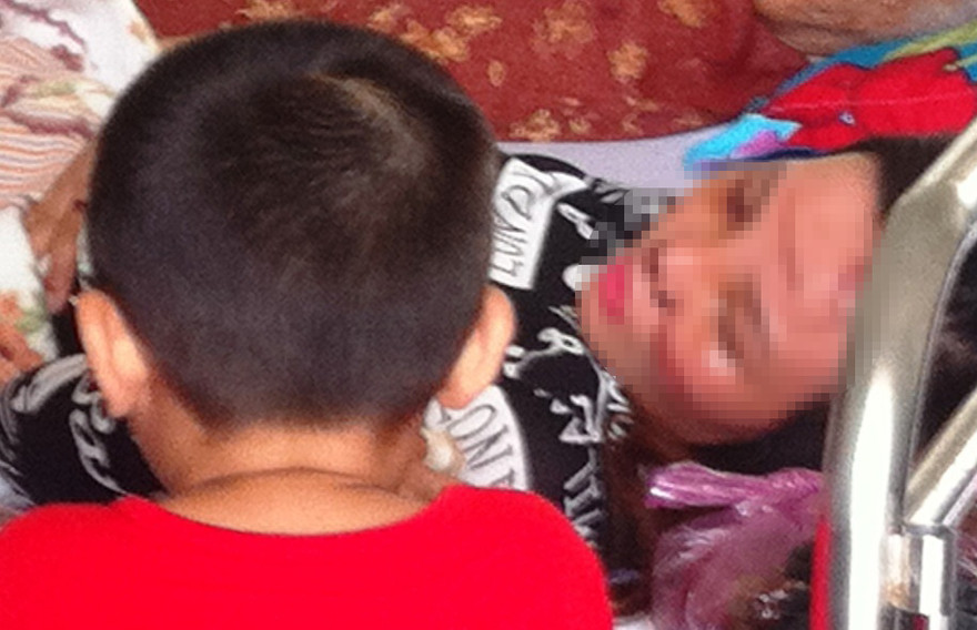 Bà Nh bị chồng ghen qua mạng cưa nát mặt.