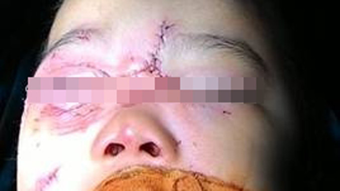 Ảnh: Bệnh viện Nhi Trung ương.