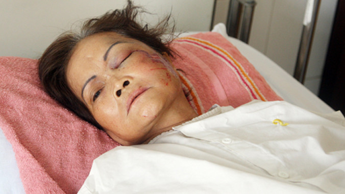 Trên đường ra đám tang đứa con trai vừa qua đời, bà Xéc bị tai nạn. Ảnh:An Nhơn.