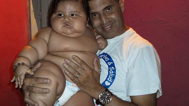 Bé trai 8 tháng nặng bằng trẻ 6 tuổi