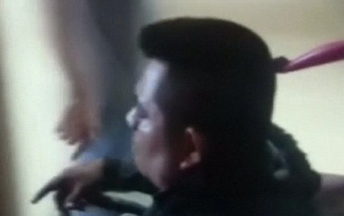 Dao cắm xuyên đầu nhưng Clever vẫn tỉnh táo.