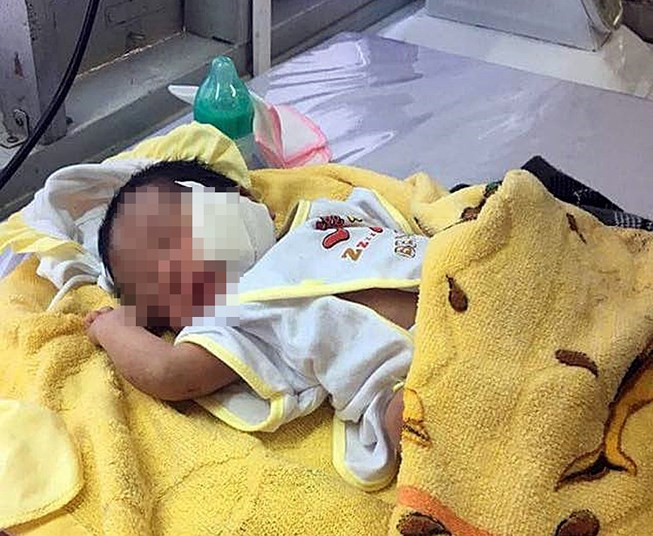 Hiện đứa bé đang được chăm sóc tại Bệnh viện La Gi