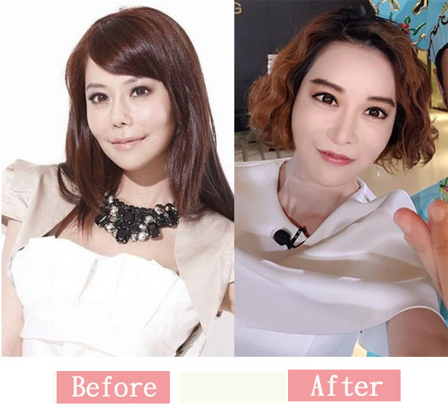 Trong làng giải trí Đài Loan, MC Triệu Tinh Nghi nổi tiếng với biệt danh “nữ hoàng nghiện phẫu thuật thẩm mỹ”.