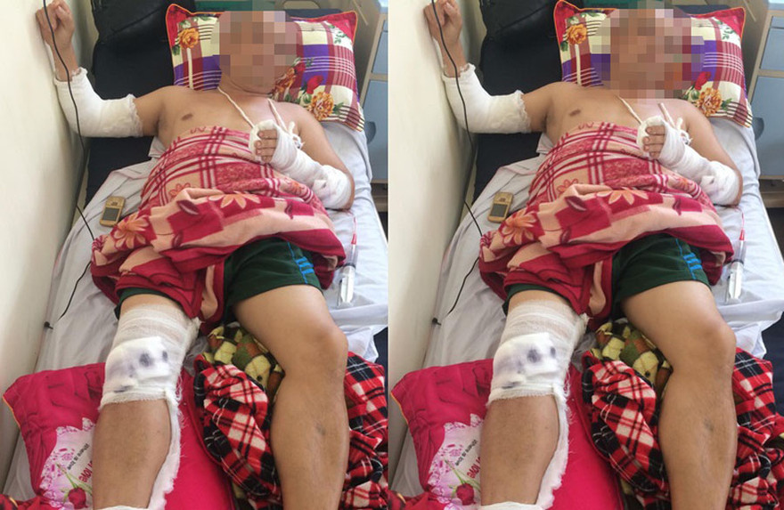 Anh Yên bị chém gục tại quán ăn đang được điều trị tại bệnh viện