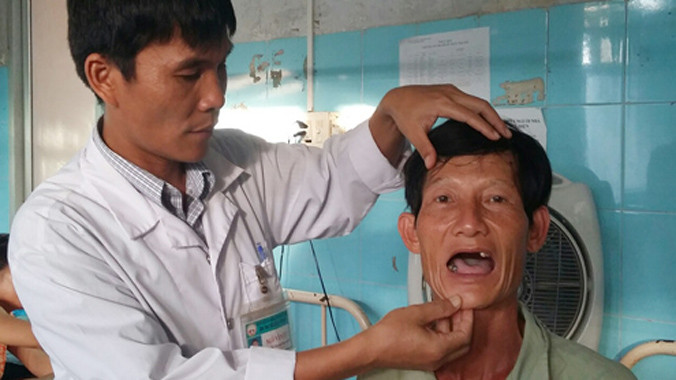 Ông Bắc với hàm răng bị nhổ gần hết vì được chẩn đoán nhầm chứng đau vùng mặt thành đau răng. Ảnh: V.Trang.