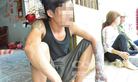 Anh Long vào can ngăn cũng bị lửa thiêu ở cánh tay.