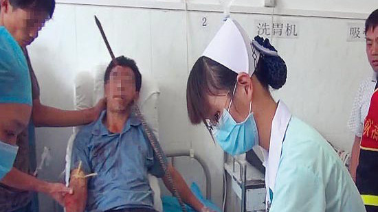 Sống sót sau khi bị thanh sắt đâm xuyên đầu