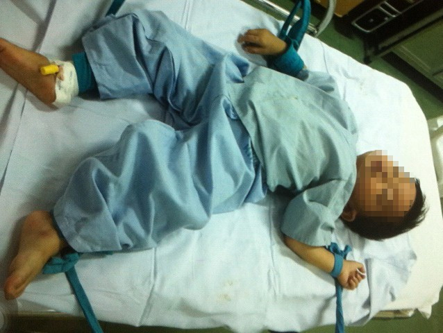 Bé T. lúc mới nhập viện sáng 30/10.