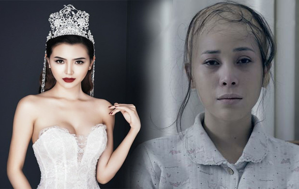 Showbiz 1/6: Sốc với hình ảnh bị ung thư của "Nữ hoàng trang sức" 2018