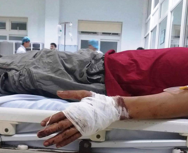 Nạn nhân bị chém gần đứt lìa tay trái. Ảnh: Báo Lao Động