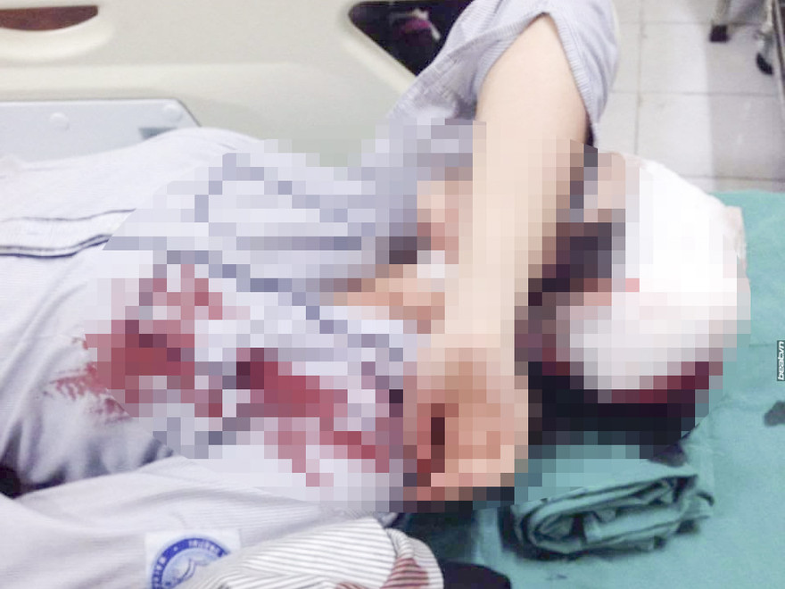 Nữ sinh đang được điều trị trong bệnh viện.