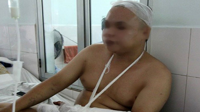 Anh Phạm đang điều trị tại bệnh viện.