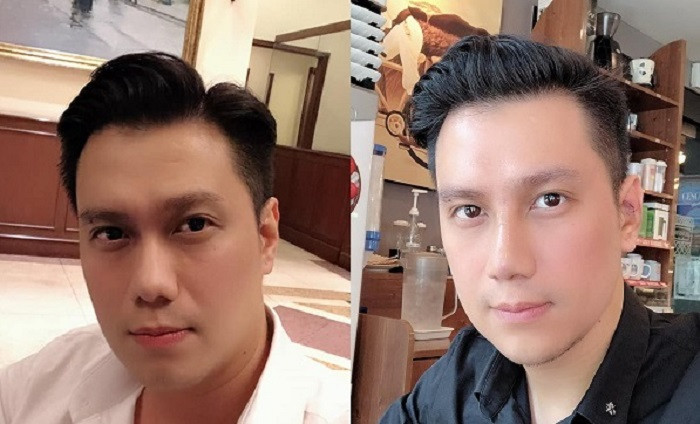 Vì sao Việt Anh vội vàng phẫu thuật thẩm mỹ ngay sau khi ly hôn?