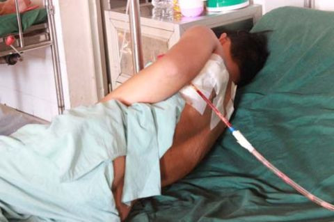 Bị bạn dùng dao đâm thủng phổi