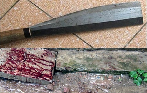 Dùng dao chặt xương, chém đứt lìa ngón tay hàng xóm