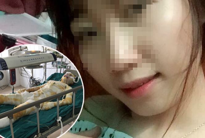 Nạn nhân trước và sau khi bị tẩm xăng đốt.