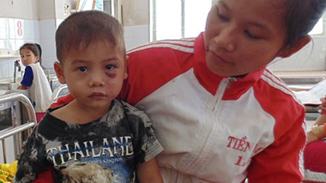 Cháu Nguyễn ở trung tâm y tế huyện