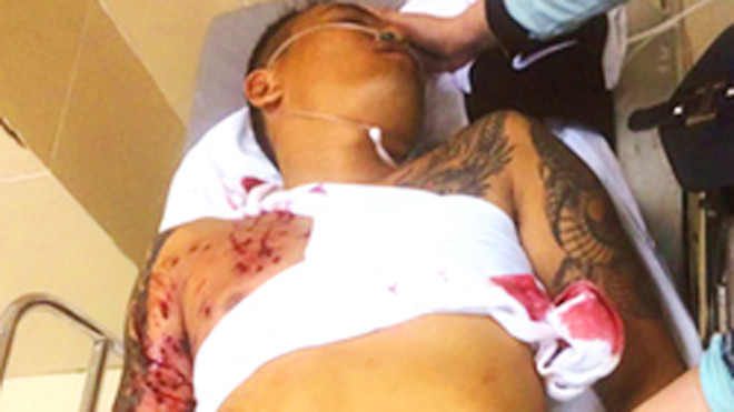 Nạn nhân lúc được đưa đi cấp cứu