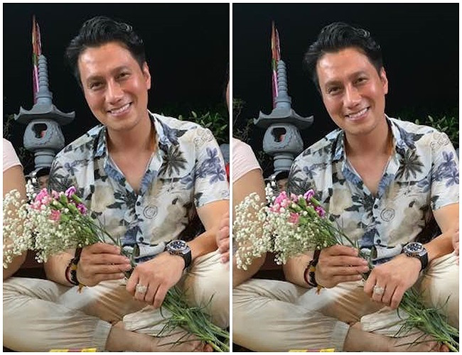 Hình ảnh mới nhất của Việt Anh sau gần 2 tháng phẫu thuật thẩm mỹ. 