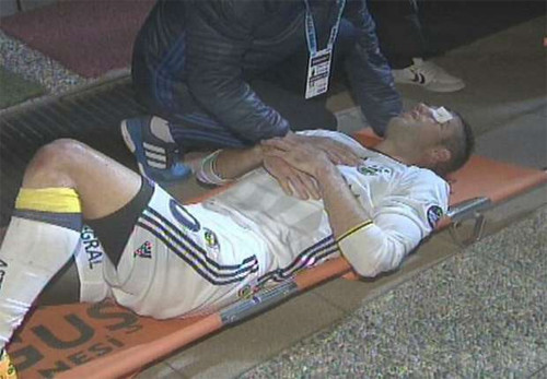 Van Persie nằm cáng rời sân sau chấn thương vùng mắt.