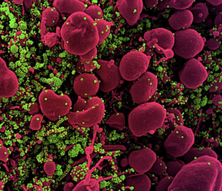 Đại dịch COVID-19 cho thấy còn nhiều lỗ hổng về quản lý đại dịch