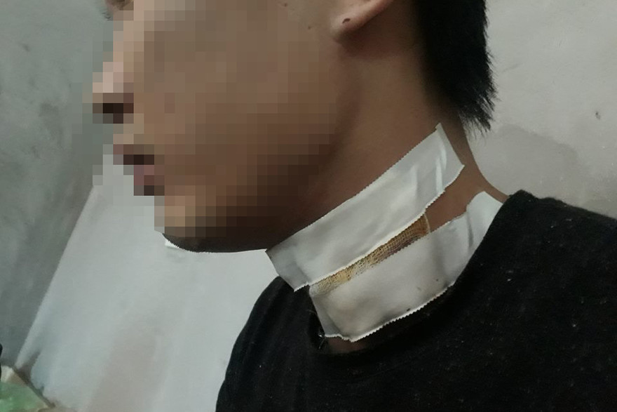 Anh T. bị thương ở cổ.
