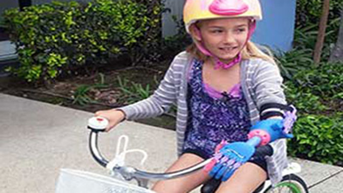 Lắp cánh tay giả chỉ với 1 triệu đồng