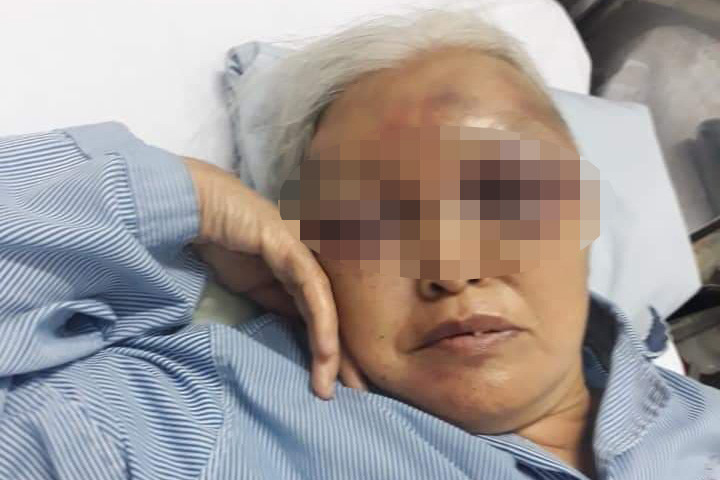 Bà Chả đang điều trị trong bệnh viện.