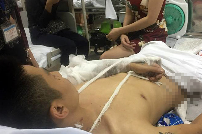 Anh H. đang điều trị tại bệnh viện.