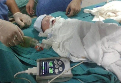 Các bác sỹ viện bỏng Quốc gia và viện 103 phối hợp cấp cứu.