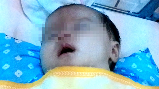 Bé Hiền đã qua cơn nguy kịch do sặc sữa nhờ được bác sĩ Hiếu cấp cứu kịp thời. Ảnh: Lê Mai