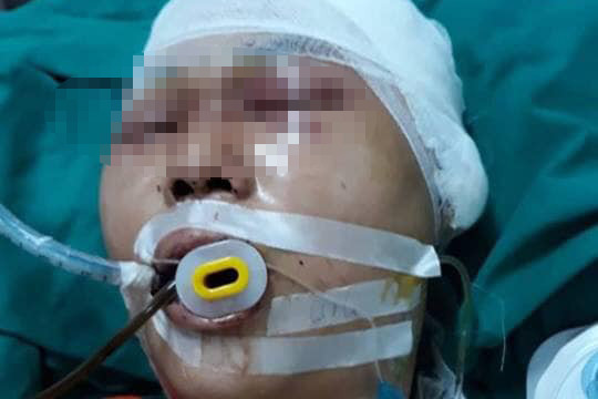 Nam sinh bị đánh chấn thương sọ não.