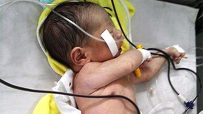 Cháu bé sơ sinh gặp nạn. 