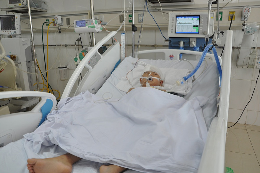 Nổ súng bắn chim, trúng đầu bé trai 10 tuổi